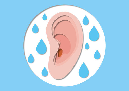 Swimmer's ear, conceptual illustration