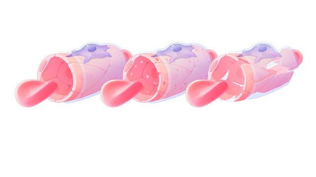 Capillary classification, illustration