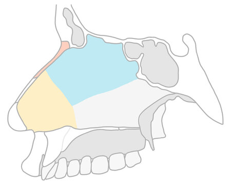 Keystone area, illustration