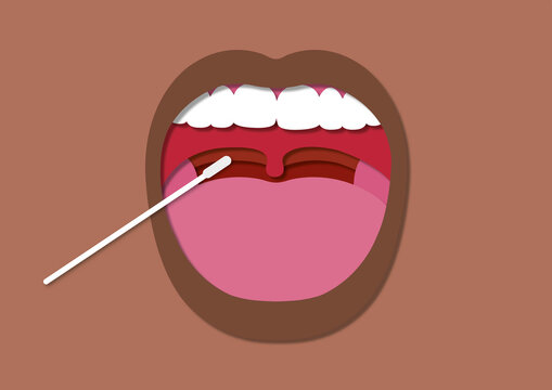 Throat swab, illustration
