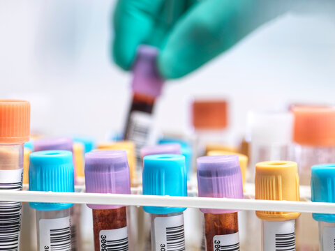 Male scientist holds a blood vial in a medical testing lab