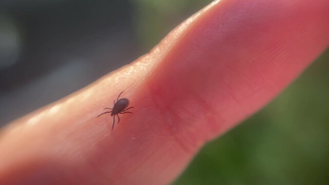 A tick crawling on a person's arm human skin macro close up