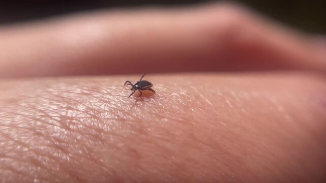 A tick crawling on a person's arm human skin macro close up