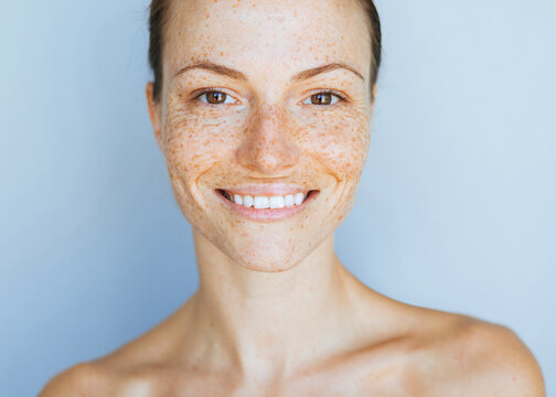 Bright Beauty skincare portrait made with a natural light, of a woman with a clean nourished skin and freckles posing against light backgorund