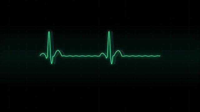 Closeup of a digital heart rate monitor screen showing a single ekg line with a rhythmic heartbeat pulse on a dark background
