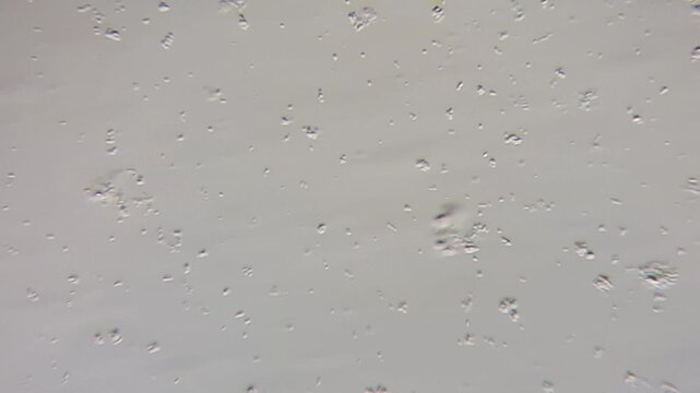 Microscopic view of bacteria causing sore throat and seasonal illness, medical microbiology lab research 