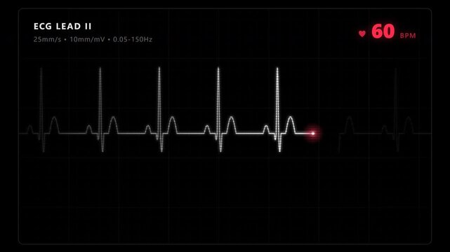 Cardiograph recording showing normal heart rate monitor on dark screen