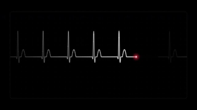 Cardiograph recording showing heart rate pulse on black background