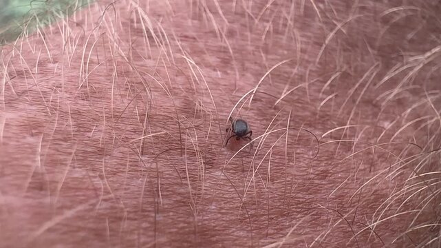 Tick crawls on a man's hand. Tick crawling along a person's hand. Encephalitis mite. Tick-borne encephalitis (TBE) is a viral infection spread by tick bites. Fatal diseases from tick bites in humans