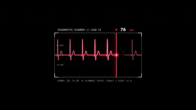 Digital cardiograph recording displaying red heart rate pulses