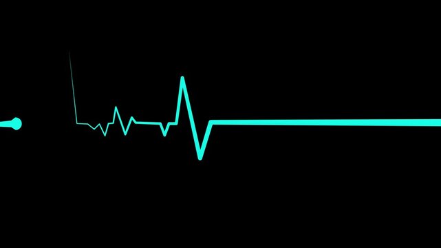 Heart beat line on graph paper showing an ecg pattern and medical signal animation