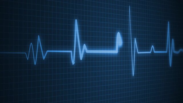 Heartbeat line showing an electrocardiogram rhythm animation