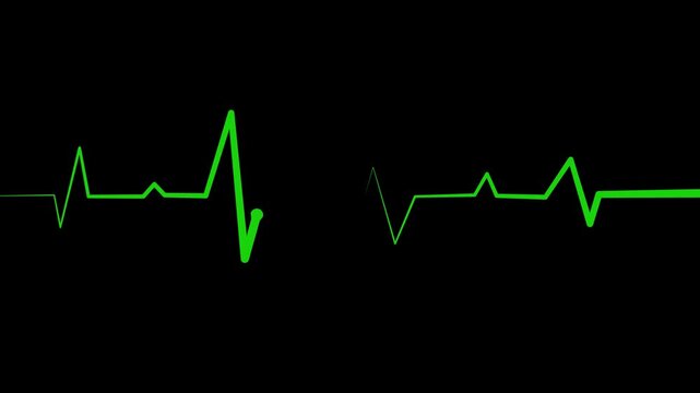 Irregular heartbeat line flat start and end, showing a medical ecg pattern and heart rhythm problem animation