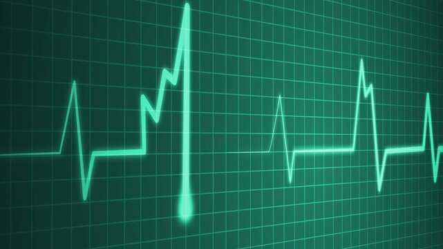 Abnormal heart rhythm line showing an ekg style medical waveform animation