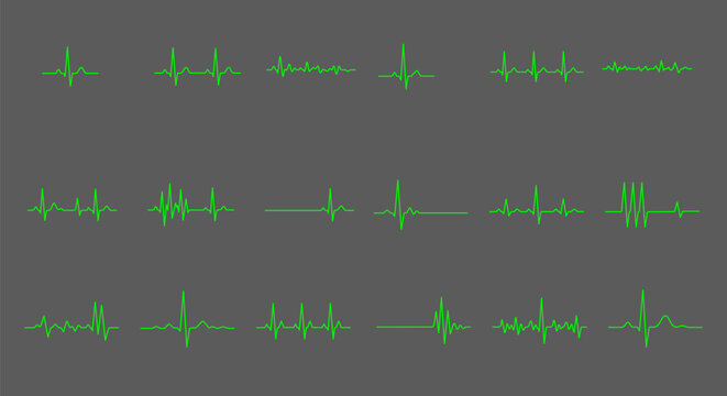 Set of green heartbeat pulse waveforms on medical ECG monitor display
