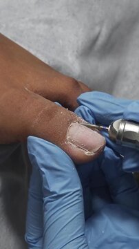 specialist using an electric nail drill to remove hardened skin and callus from a client's heel during a foot care treatment. Medical pedicure, dry skin removal, and foot hygiene.