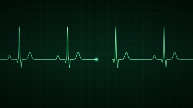 Electrocardiogram Heartbeat Rhythm Strip with Clear Cardiac Cycle Display