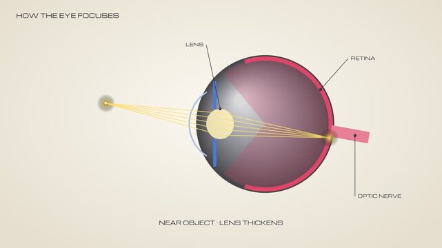 Diagram illustrating how the human eye focuses on near objects by thickening its lens