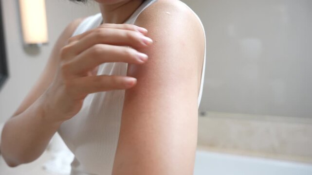 skin problem and beauty. Young woman scratch body has itchy skin from skin allergic, steroid allergy, sensitive skin, red from sunburn, chemical allergy, rash, insect bites, Seborrheic Dermatitis.