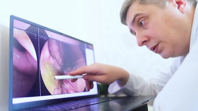 Gastroenterologist doctor examining endoscopy endoscopy results on a laptop showing bile reflux in the stomach. Specialist explaining gastroscopy stomach diagnosis during medical consultation.