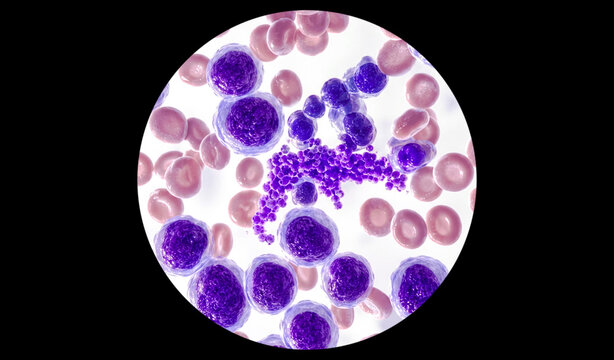 Platelet clumps, WBC and RBC analysed by light microscope. 3D illustration