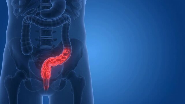 3D medical animation of the human digestive system showing movement through the large intestine with arrows on a blue background.