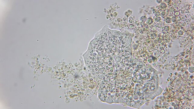 Amoeba microorganism extending pseudopodia and changing shape under 400x brightfield microscopy 4K