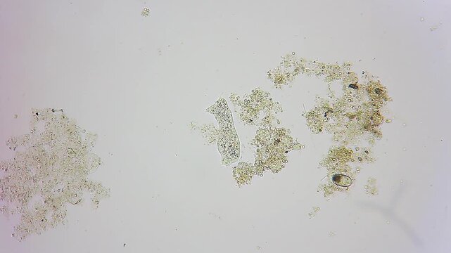 Microscopic amoeba changing shape and moving near organic detritus under 100x brightfield microscopy 4K