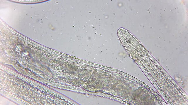 Internal organs and developing eggs inside a translucent nematode under 400x brightfield microscopy 4K
