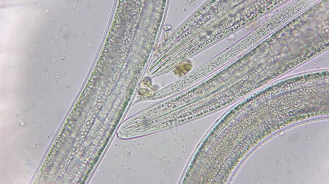 Detailed anatomy of nematode roundworm showing anterior end with stylet under 400x brightfield microscopy 4K