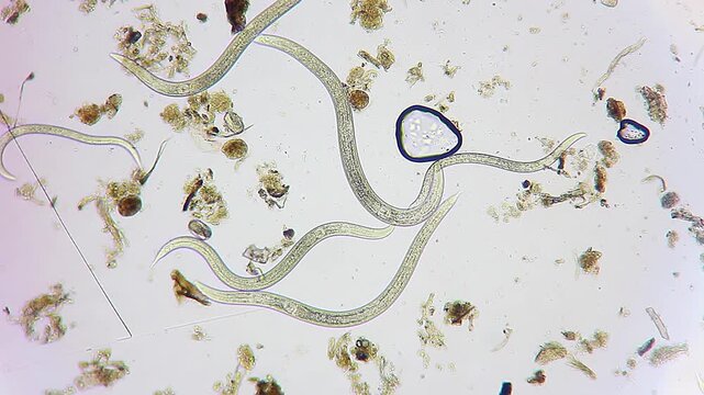 Active nematode roundworms swimming through organic debris under 100x brightfield microscopy 4K