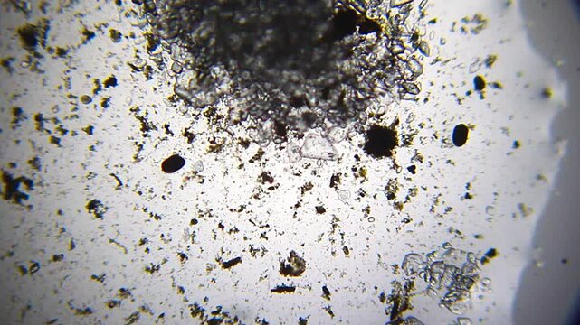 Salt crystals dissolving in a dirty water drop under 40x brightfield microscopy 4K