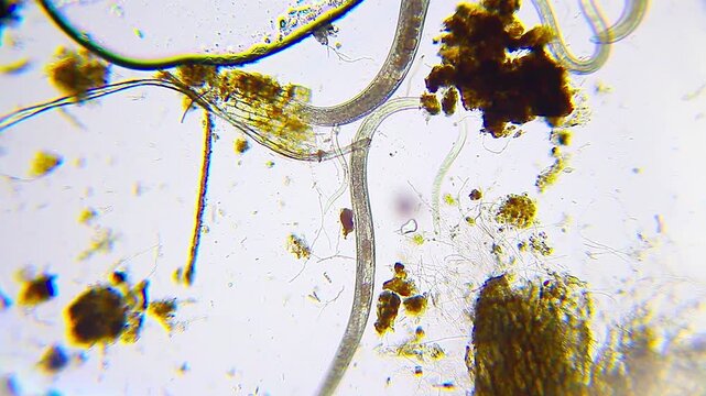 Active nematode roundworms swimming through organic detritus under 100x brightfield microscopy 4K