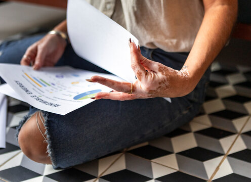 Woman with vitiligo reviewing business report at home