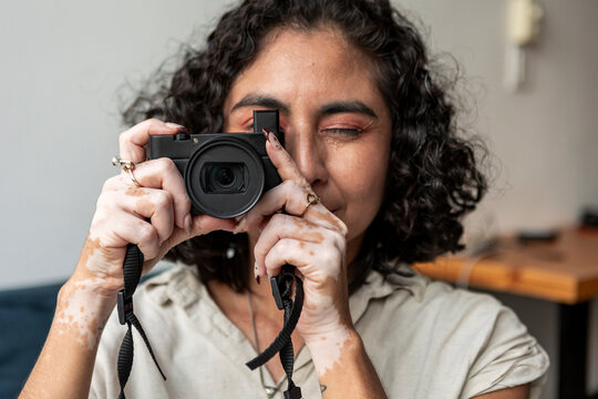 Woman with vitiligo take a photograph with camera