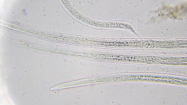 Panoramic view of non-moving nematode roundworms under 400x brightfield microscopy 4K