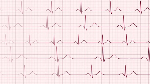 A close up digital illustration of an electrocardiogram readout showing rhythmic heart rate patterns on a standardized light pink background