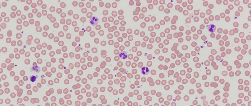 Microscopic view of blood smear red blood cells platelets and neutrophils Medical research hematology science concept