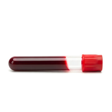 Blood sample in red capped test tube isolated on white background