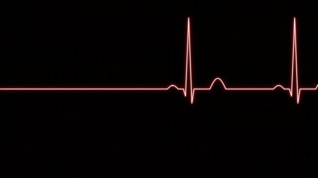 Seamless ECG Heartbeat Pulse Animation on Black Background Medical Health Monitor