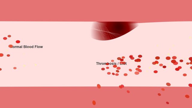 Blood Clot Formation Animation in Artery Medical Science Concept