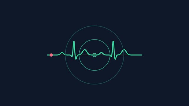 Animated ECG heartbeat line with pulsing wave, flat vector medical health monitor concept, seamless loop