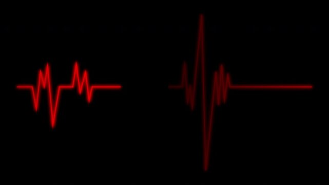 Cardiograph recording pulse featuring heartbeat flatline on black background. 4k animation