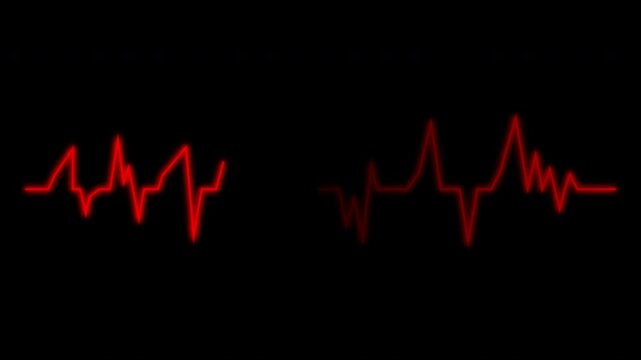 Cardiograph recording pulse featuring heartbeat flatline on black background. 4k animation