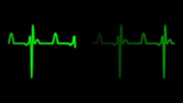 Cardiograph recording pulse featuring heartbeat flatline on black background. 4k animation