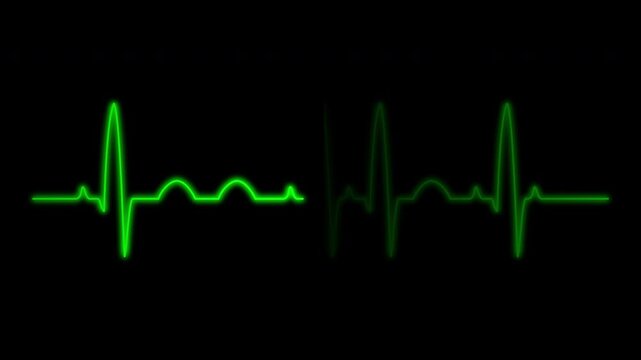 Cardiograph recording pulse featuring heartbeat flatline on black background. 4k animation