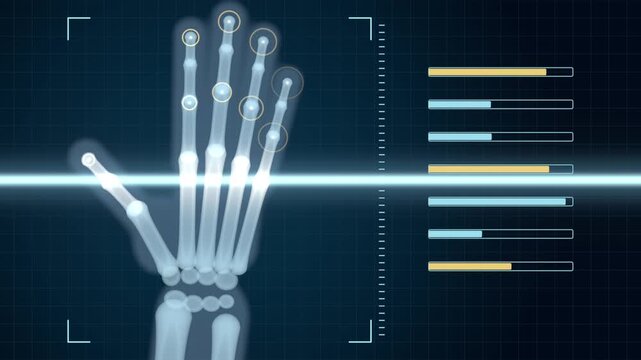 X ray hand scan seamless loop bones skeleton radiology medical scanner glowing blue hand bones with a sweeping scan line and data bars for healthcare apps orthopedics and clinic promos