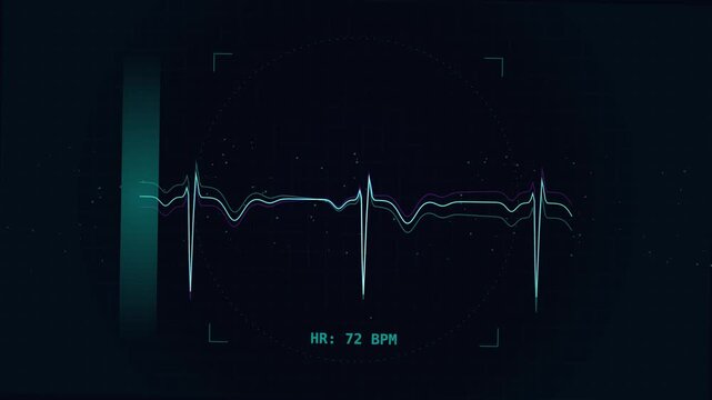 Digital medical ecg heart rate monitor graph displaying pulse