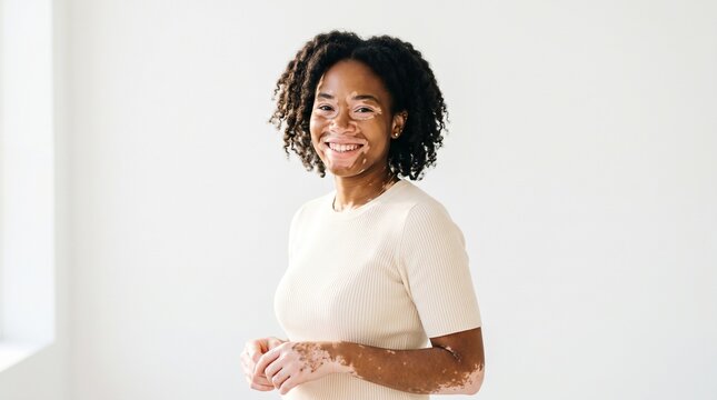 Smiling young Black woman with vitiligo skin condition wearing a cream colored shirt against a white background