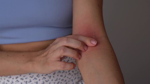 Young woman shows irritated inner elbow on gray background, demonstrating red rash, allergy, dermatitis, eczema and inflamed sensitive skin